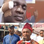 Abia Assembly Majority Leader Smashes Beer Bottle On Colleague’s Head