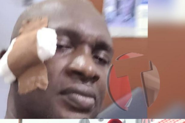 Abia Assembly Majority Leader Smashes Beer Bottle On Colleague’s Head