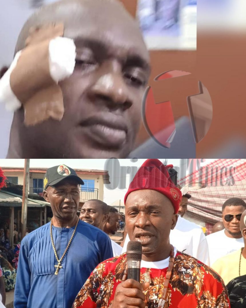 Abia Assembly Majority Leader Smashes Beer Bottle On Colleague’s Head